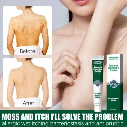 South Moon Wet Search Herbal Cream Skin Cream Moisturizes Hydrates And Reduces Itching Herbal Cream
