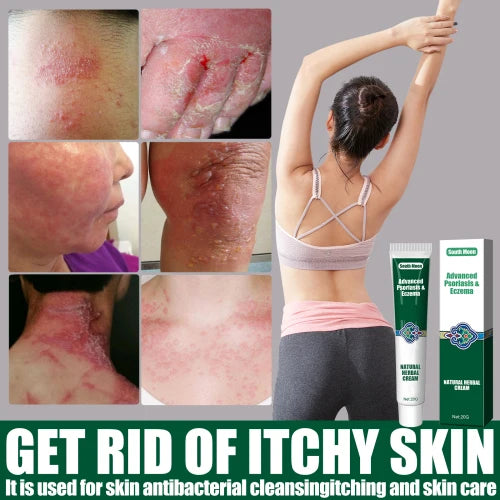 South Moon Wet Search Herbal Cream  Skin Cream Moisturizes  Hydrates And Reduces Itching Herbal Cream