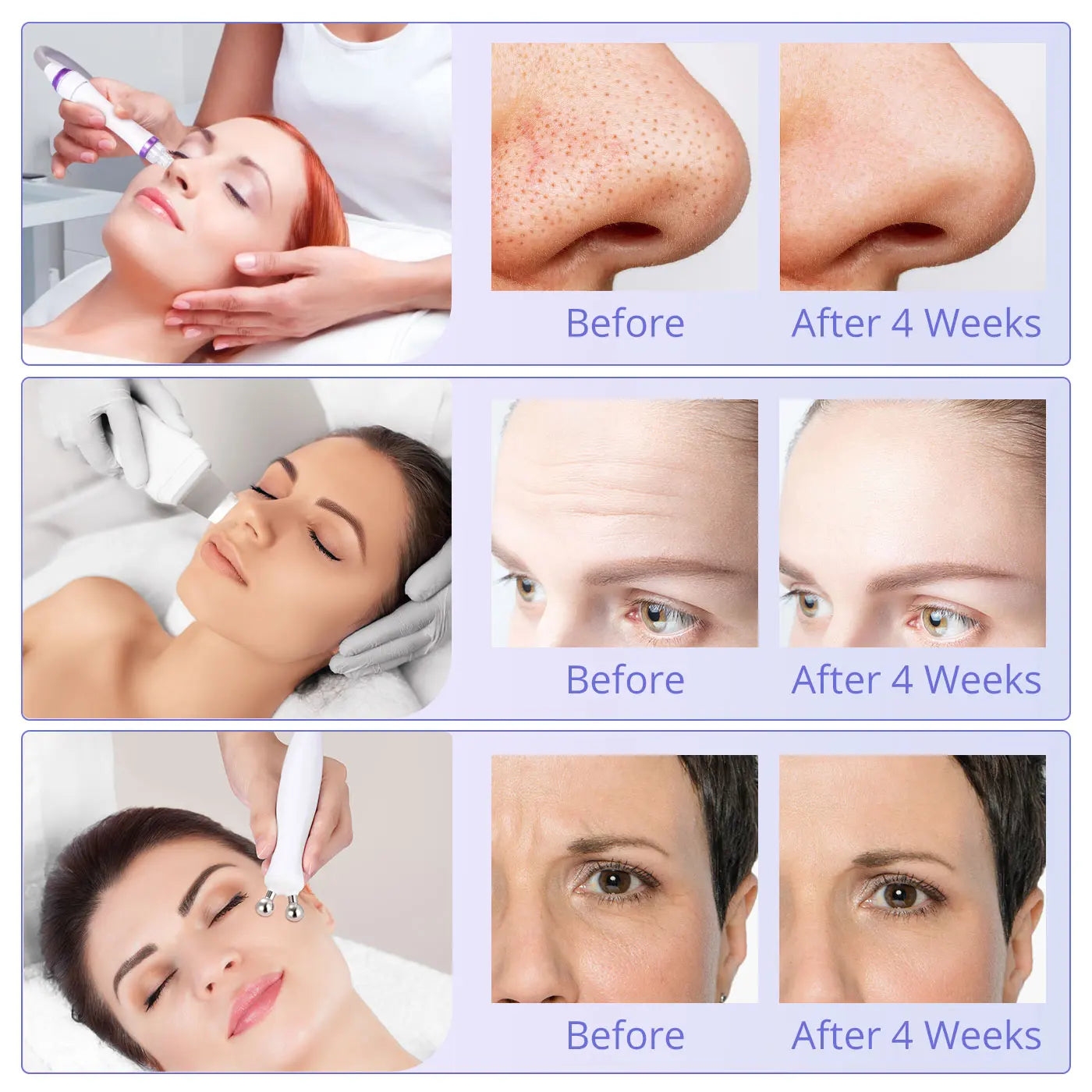 Beauty Facial Machine Blackhead Removal Skin Scrubber Facial Clean Machine